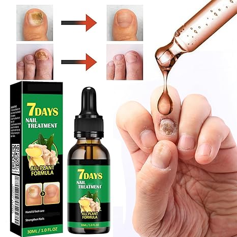 7 Days tratamiento hongos ® Protege y elimina el hongo de tus uñas