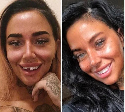 Carillas Dentales Premium pague 1 lleve 2 ® - Perfecto para muecos & dientes amarillos