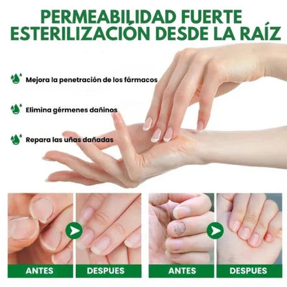 7 Days tratamiento hongos ® Protege y elimina el hongo de tus uñas